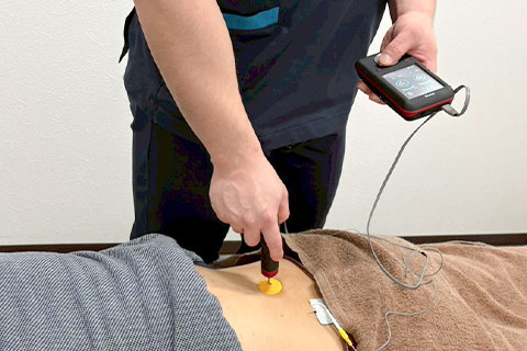 ハイボルテージ電気療法